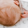 fisioterapia infantil - torticolis congenita